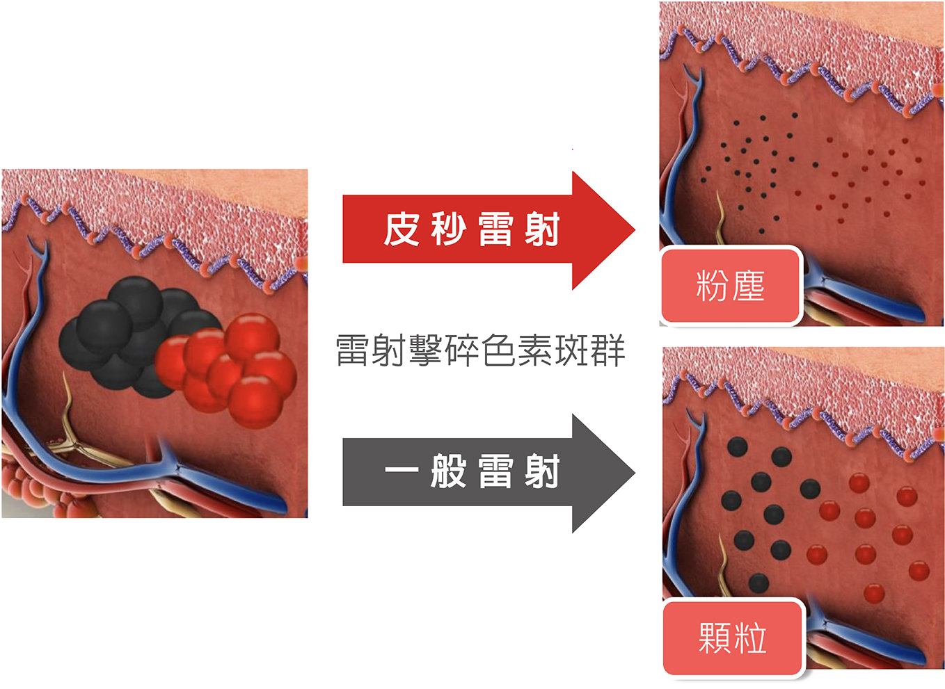 煥膚飛梭