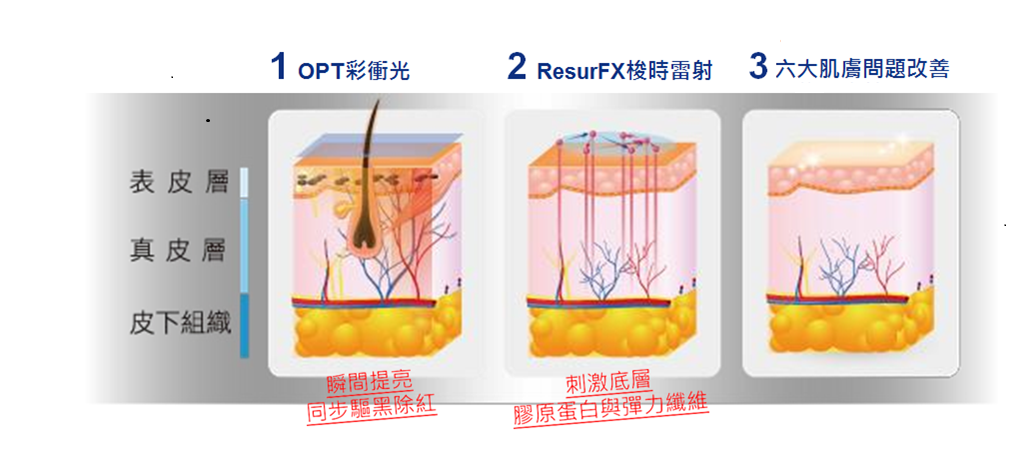 有別於傳統雷射