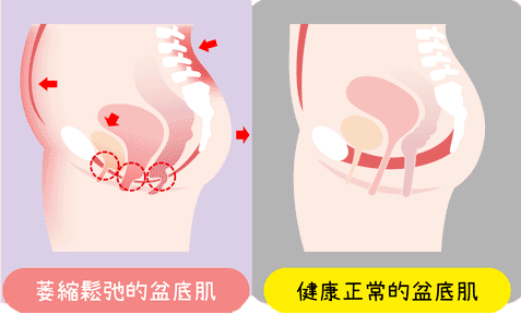 增加骨盆肌肉群