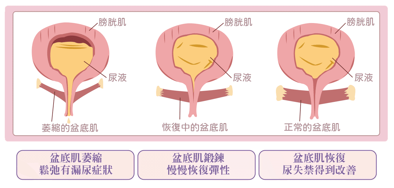 增加骨盆肌肉群