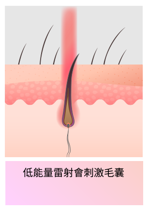 刺激毛囊